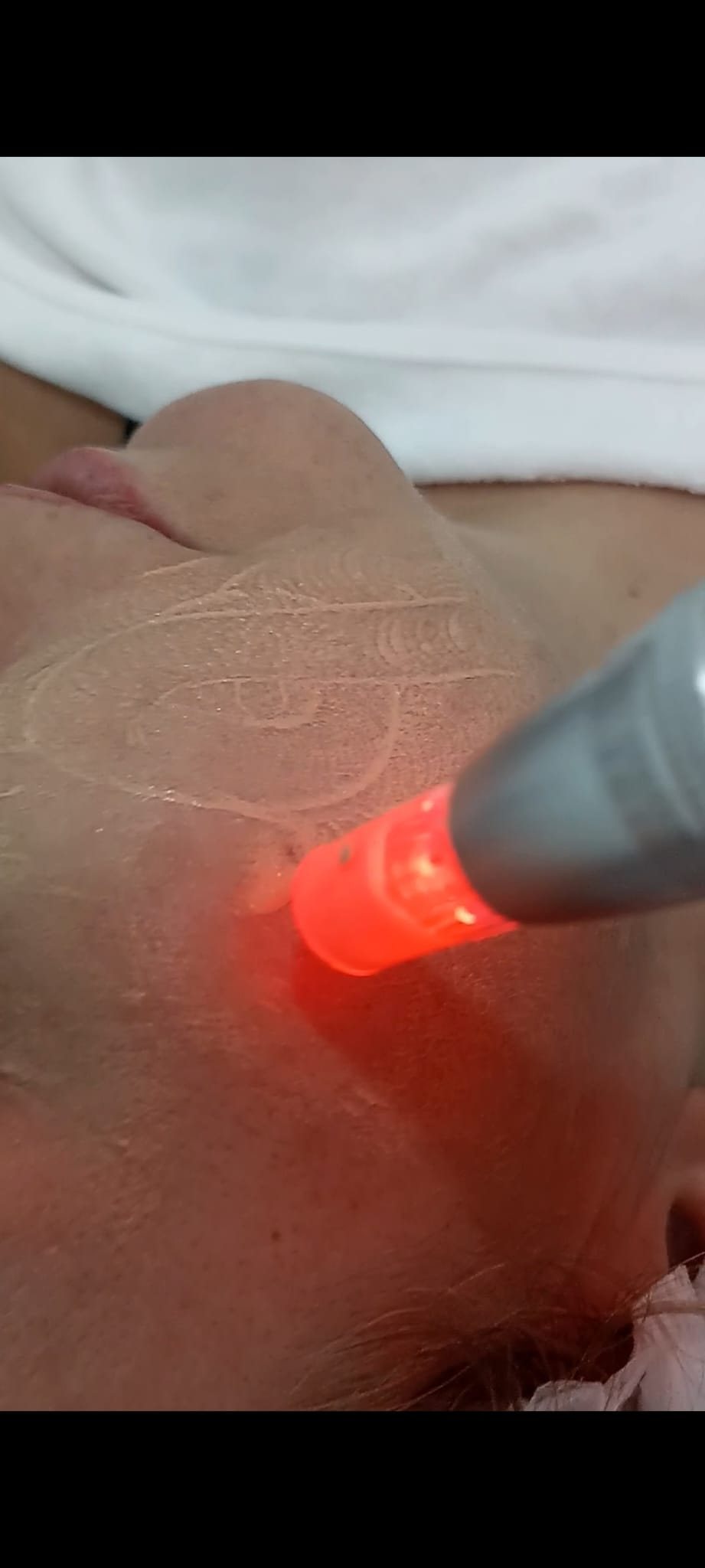 Bbglow
