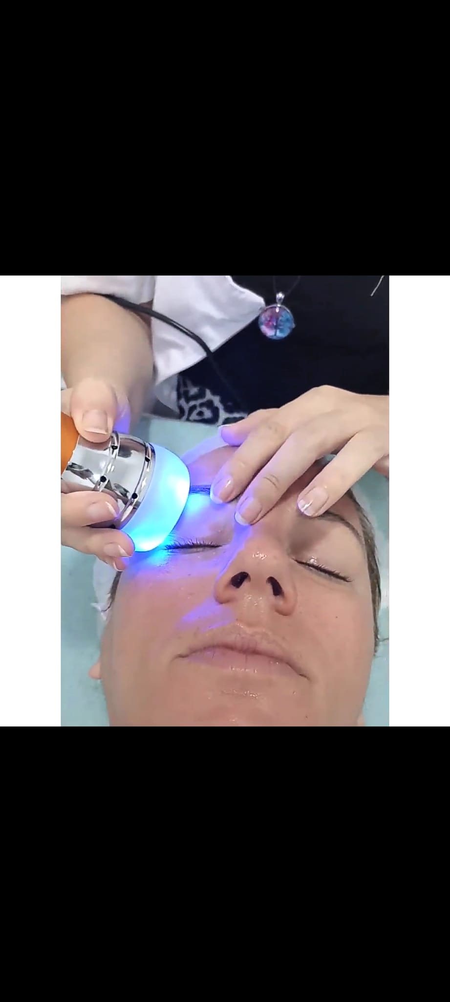 Mesoterapia virtual facial