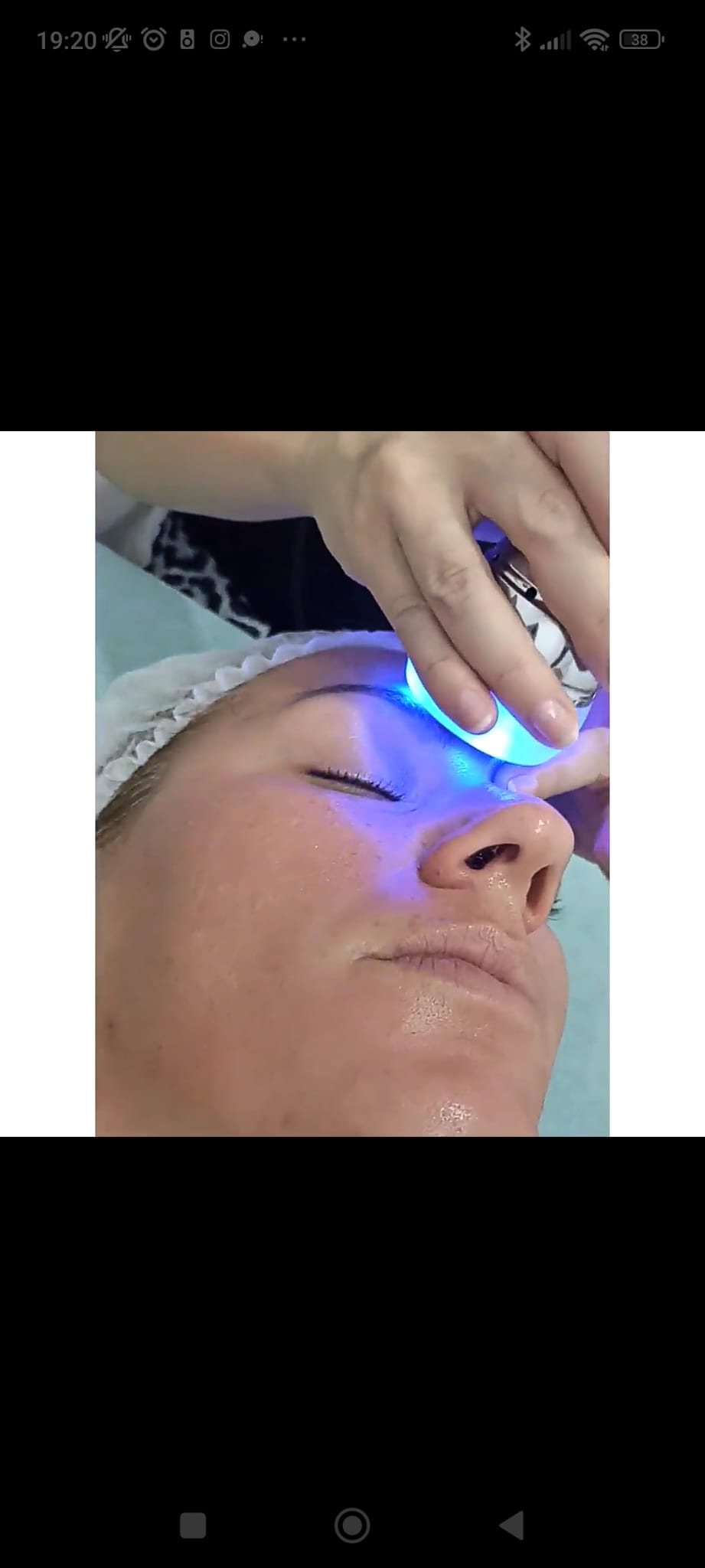 Mesoterapia virtual facial
