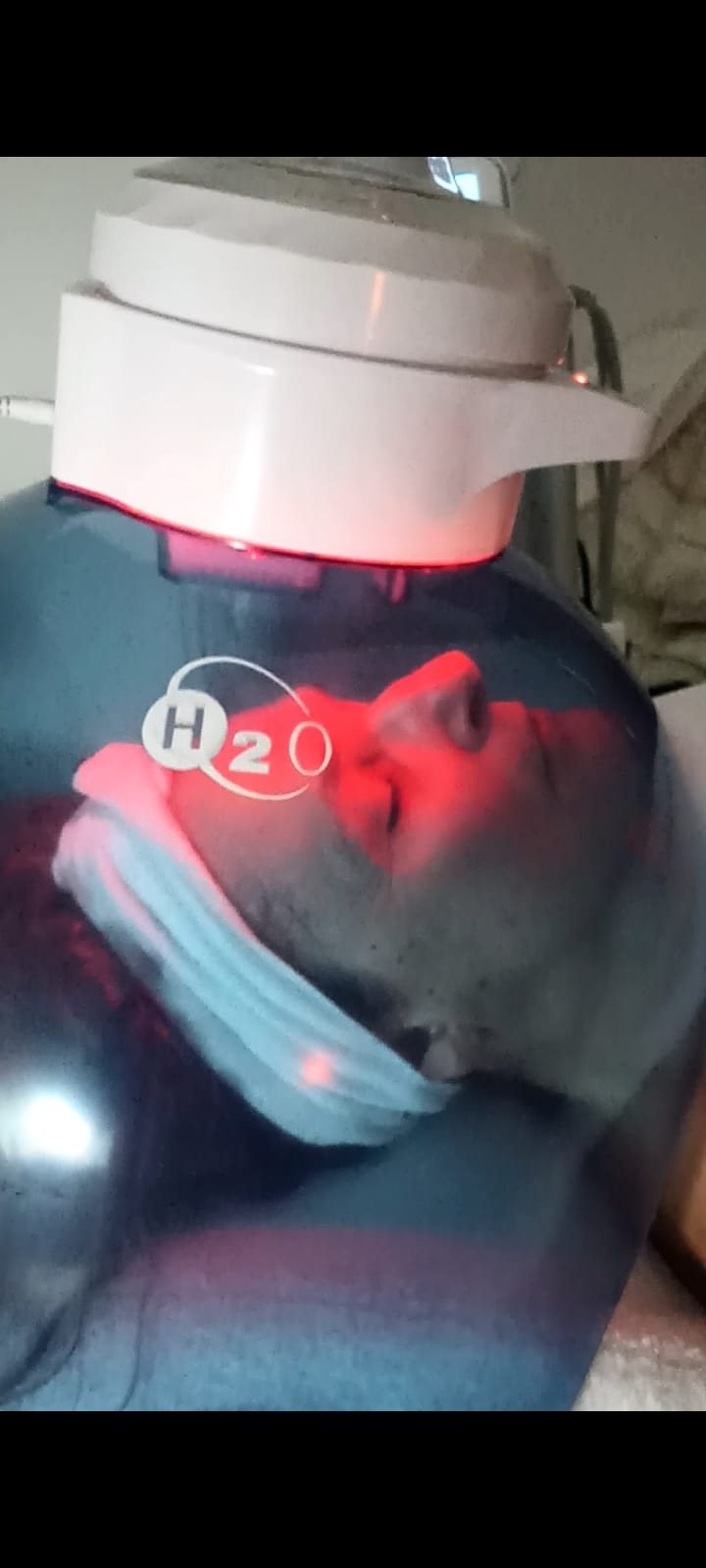 OXIGENOTERAPIA