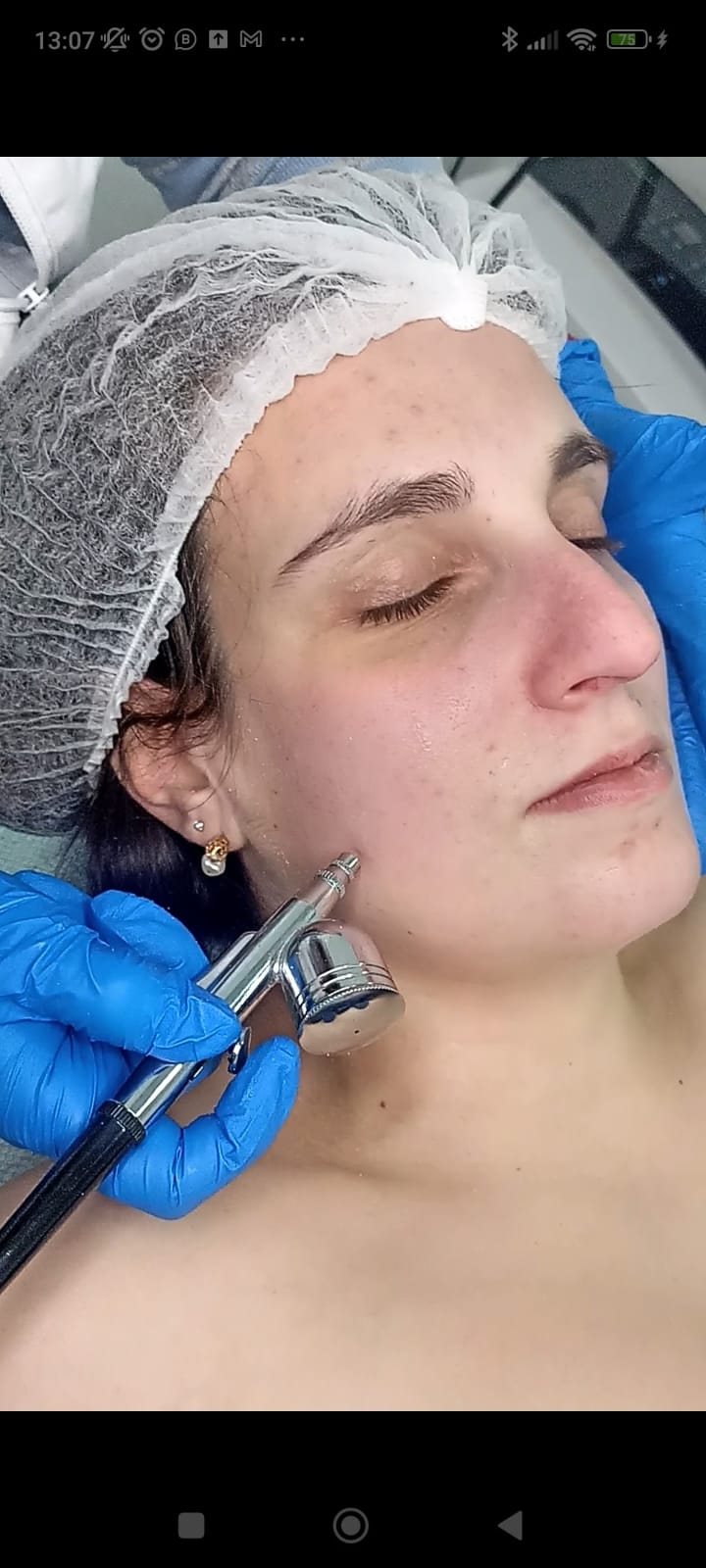 OXIGENOTERAPIA