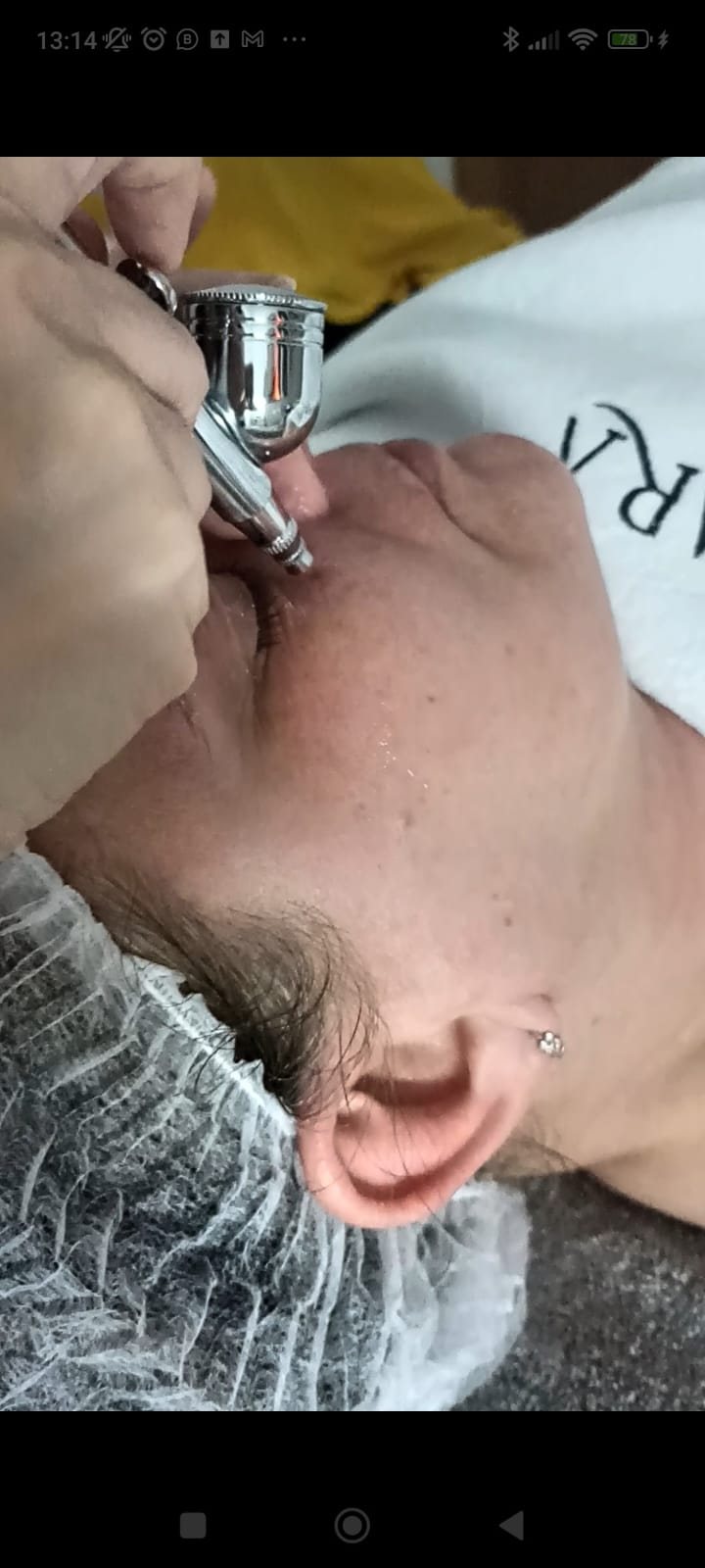 OXIGENOTERAPIA