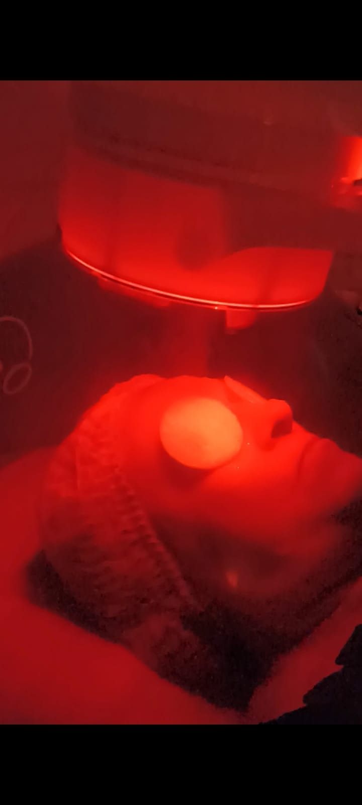 OXIGENOTERAPIA